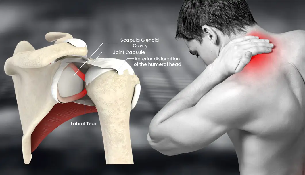 Shoulder Pain Clinic Indore
