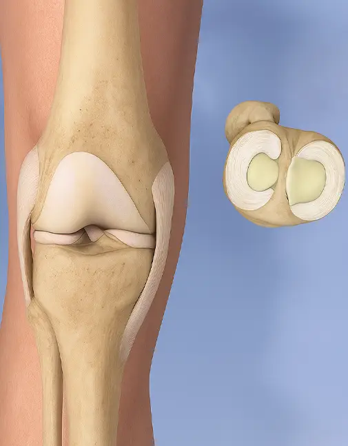 Best Knee Doctor near me (Indore)
