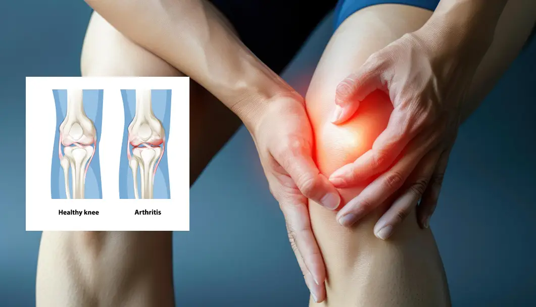 Meniscus Tear Surgery in Indore