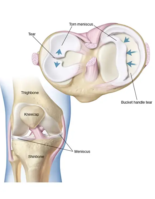 Orthopedic Sports Injury Doctor Indore