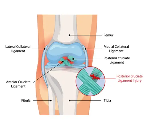 Best Sports Injury Treatment in Indore