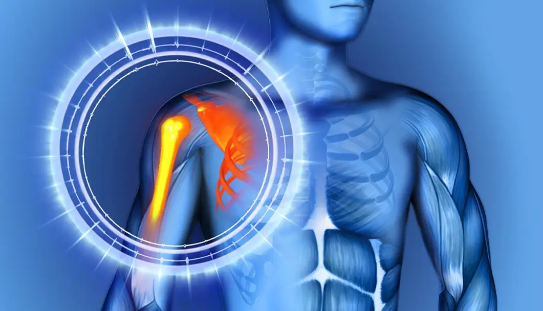 Shoulder Arthroscopy in Indore