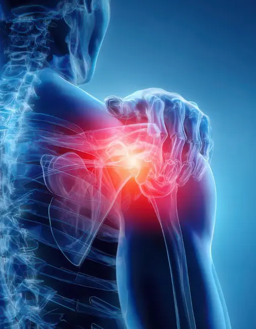 Shoulder Injury Doctor in Indore