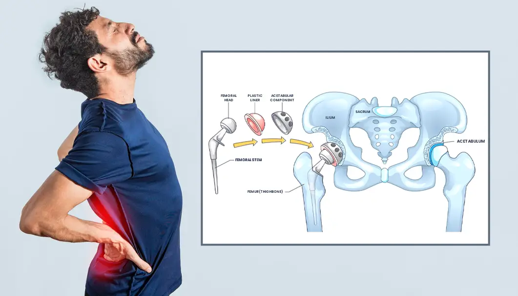 Hip Surgeon in Indore