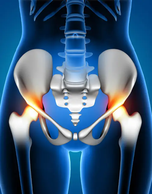 Hip Specialist in Indore